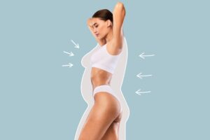 Profile of a woman with arrows outlining areas for contouring, showcasing results of a body lift procedure for a toned and sculpted shape