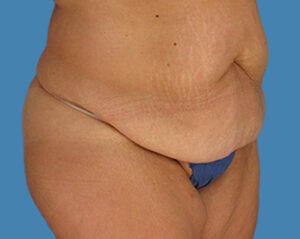 Before Image: