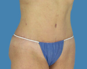 After Image: