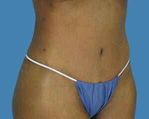 After Image:
