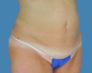 Before Image: