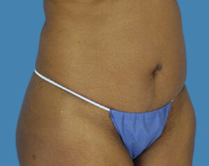 Before Image:
