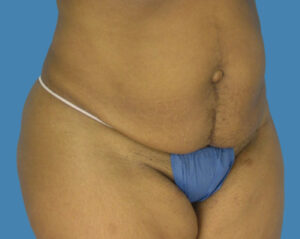 Before Image: