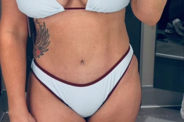 patient-stories-a--Foster-4a