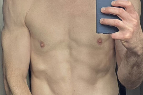 patient-stories-l-goetz-1