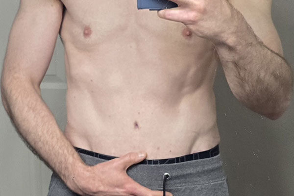 patient-stories-l-goetz-2